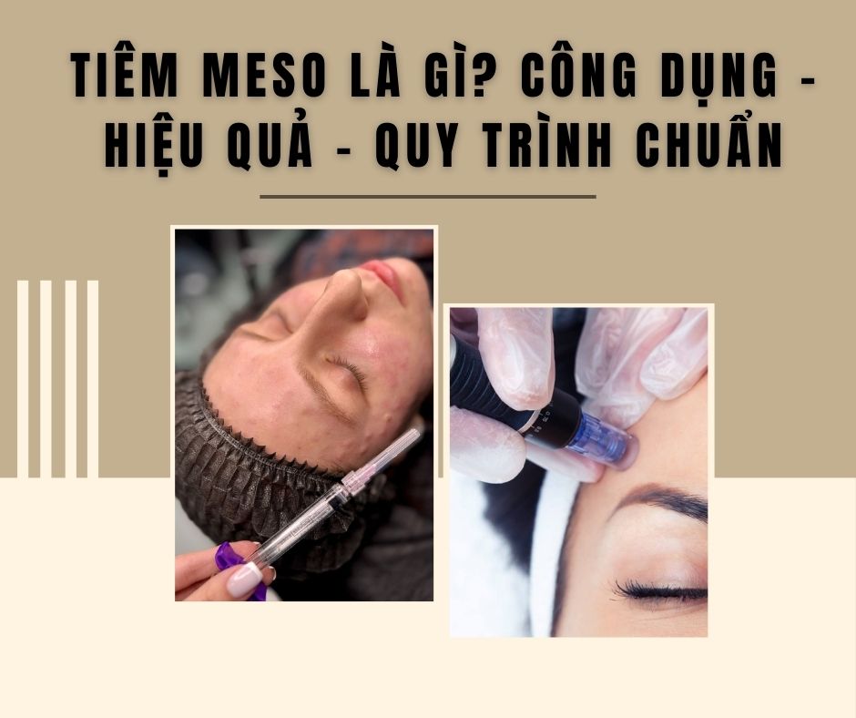 Tiêm Meso Là Gì? Công Dụng – Hiệu Quả – Quy Trình Chuẩn