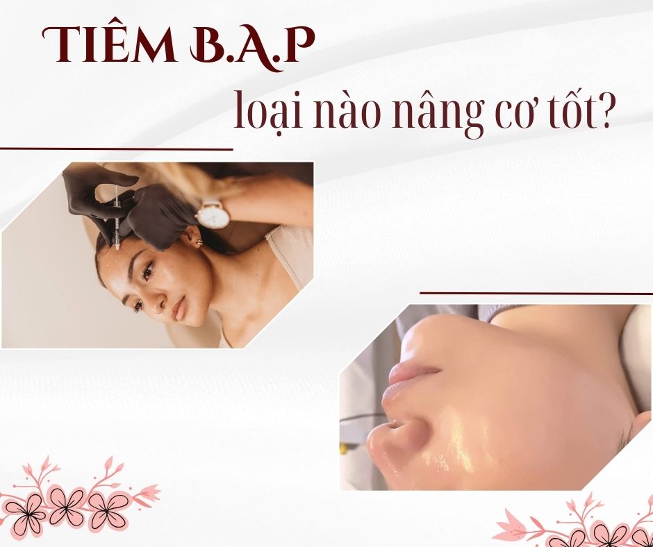 Tiêm B.A.P loại nào nâng cơ tốt?