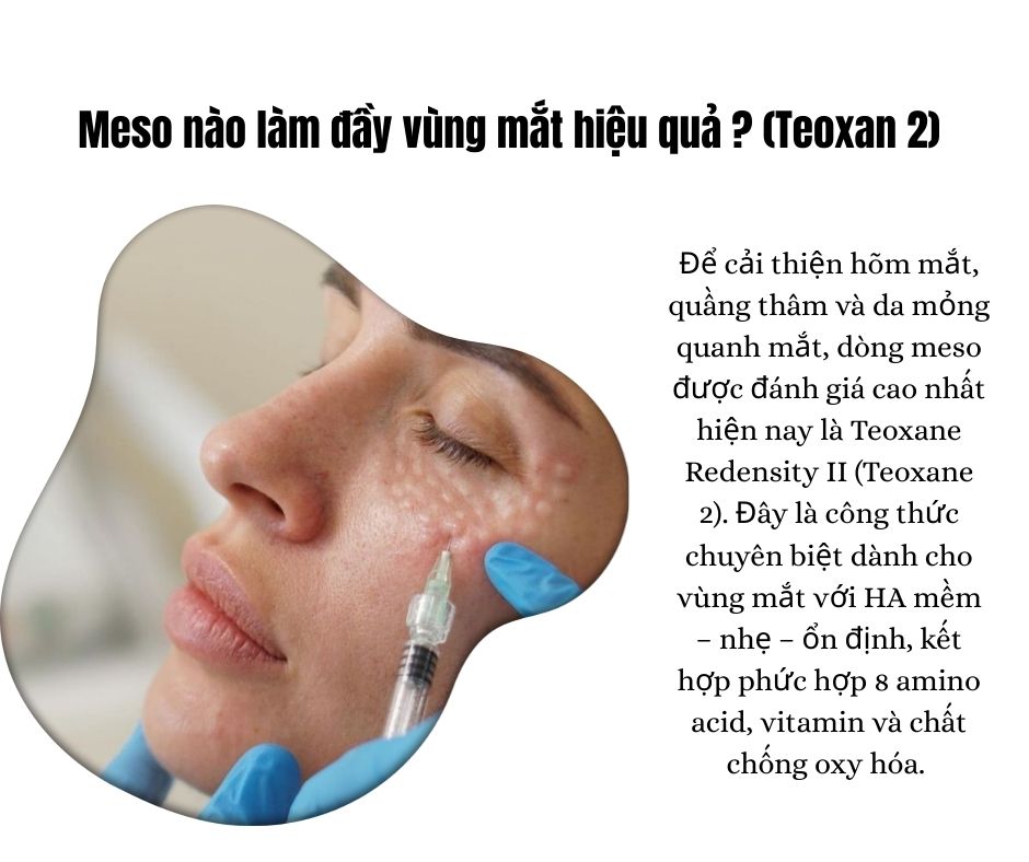 Meso nào làm đầy vùng mắt hiệu quả ? (Teoxan 2)