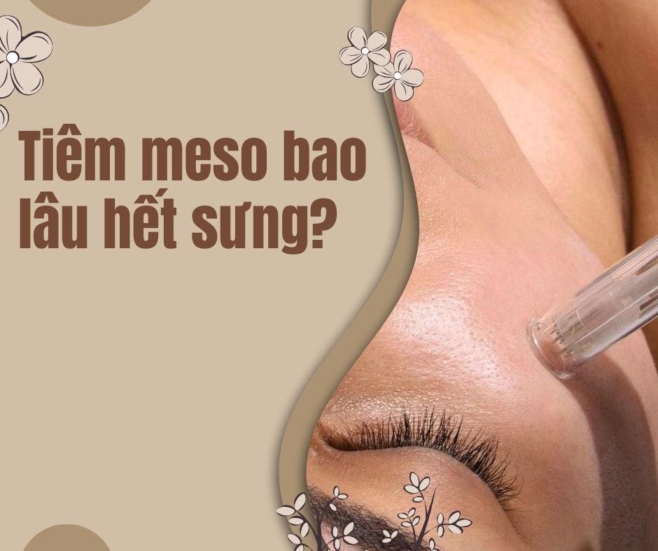 Tiêm meso bao lâu hết sưng?