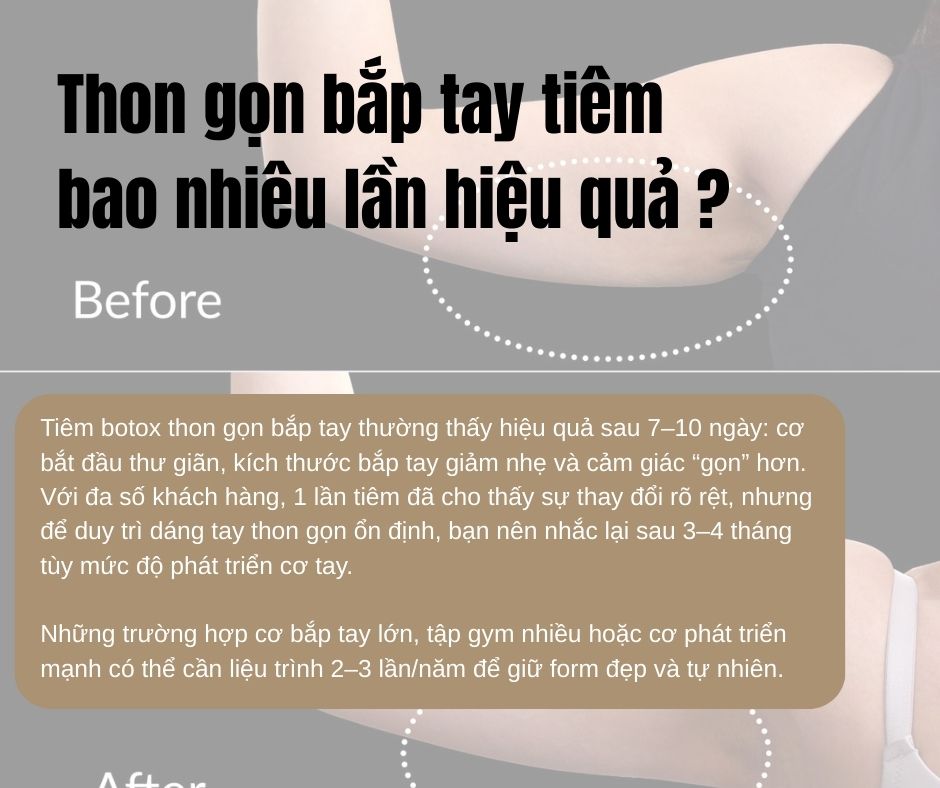 Thon gọn bắp tay tiêm bao nhiêu lần hiệu quả ?