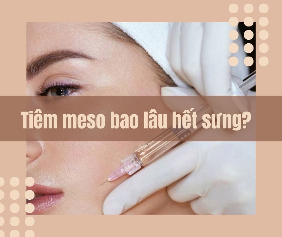 Tiêm meso bao lâu hết sưng?