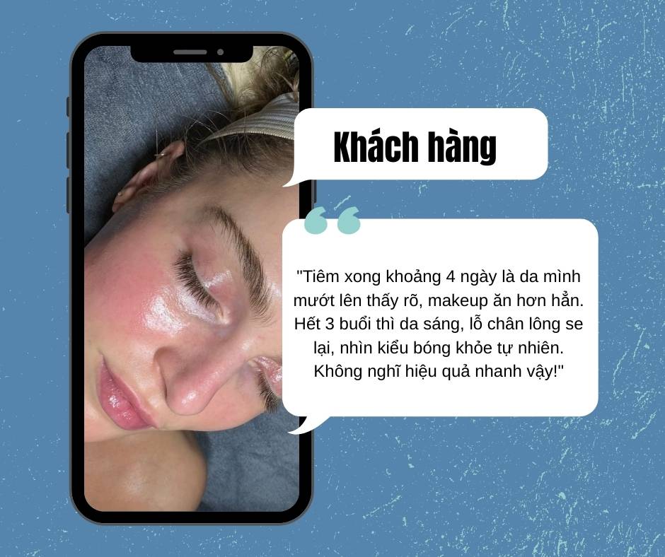 Tiêm Meso bao lâu thì thấy hiệu quả?
