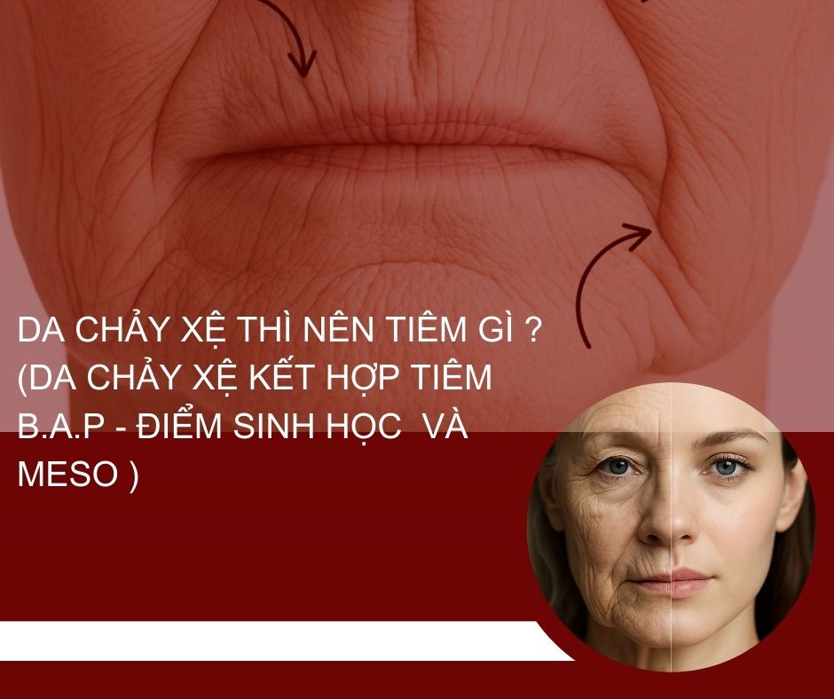 Da chảy xệ thì nên tiêm gì ? (da chảy xệ kết hợp tiêm B.A.P - điểm sinh học và meso )