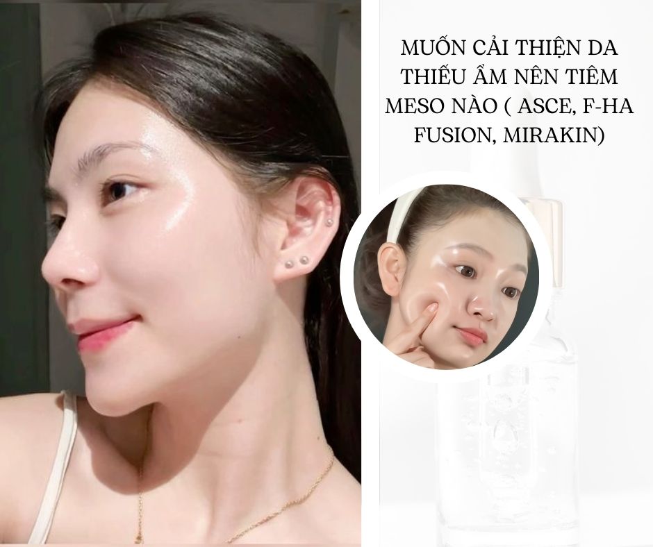 Muốn cải thiện da thiếu ẩm nên tiêm meso nào ( Asce, F-HA Fusion, Mirakin)