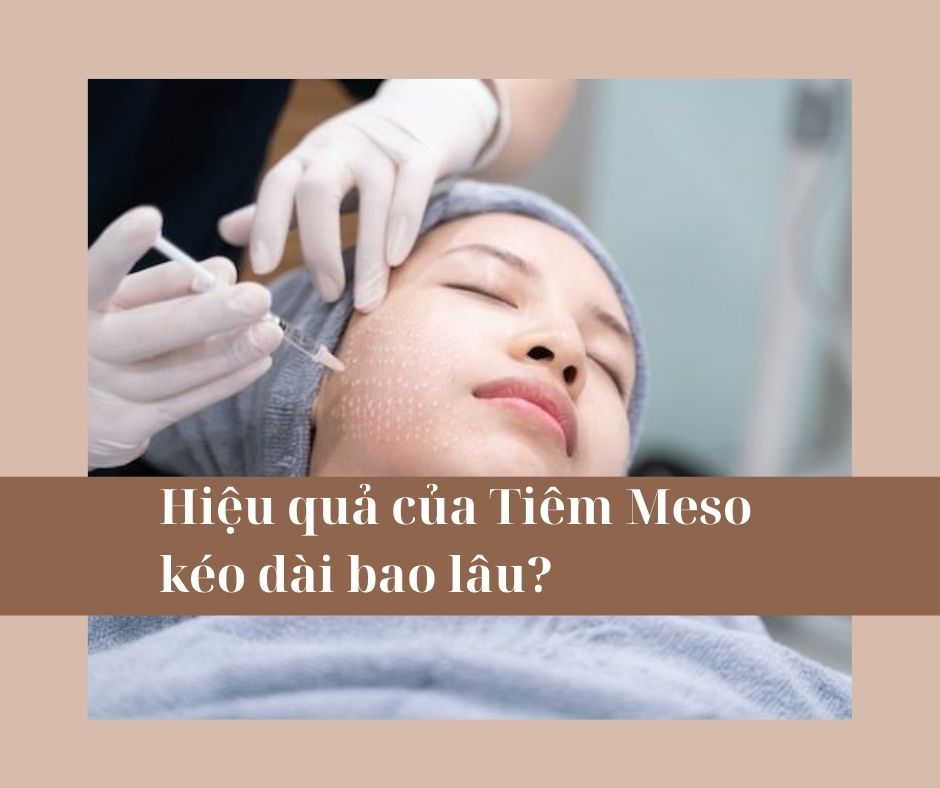 Hiệu quả của Tiêm Meso kéo dài bao lâu?