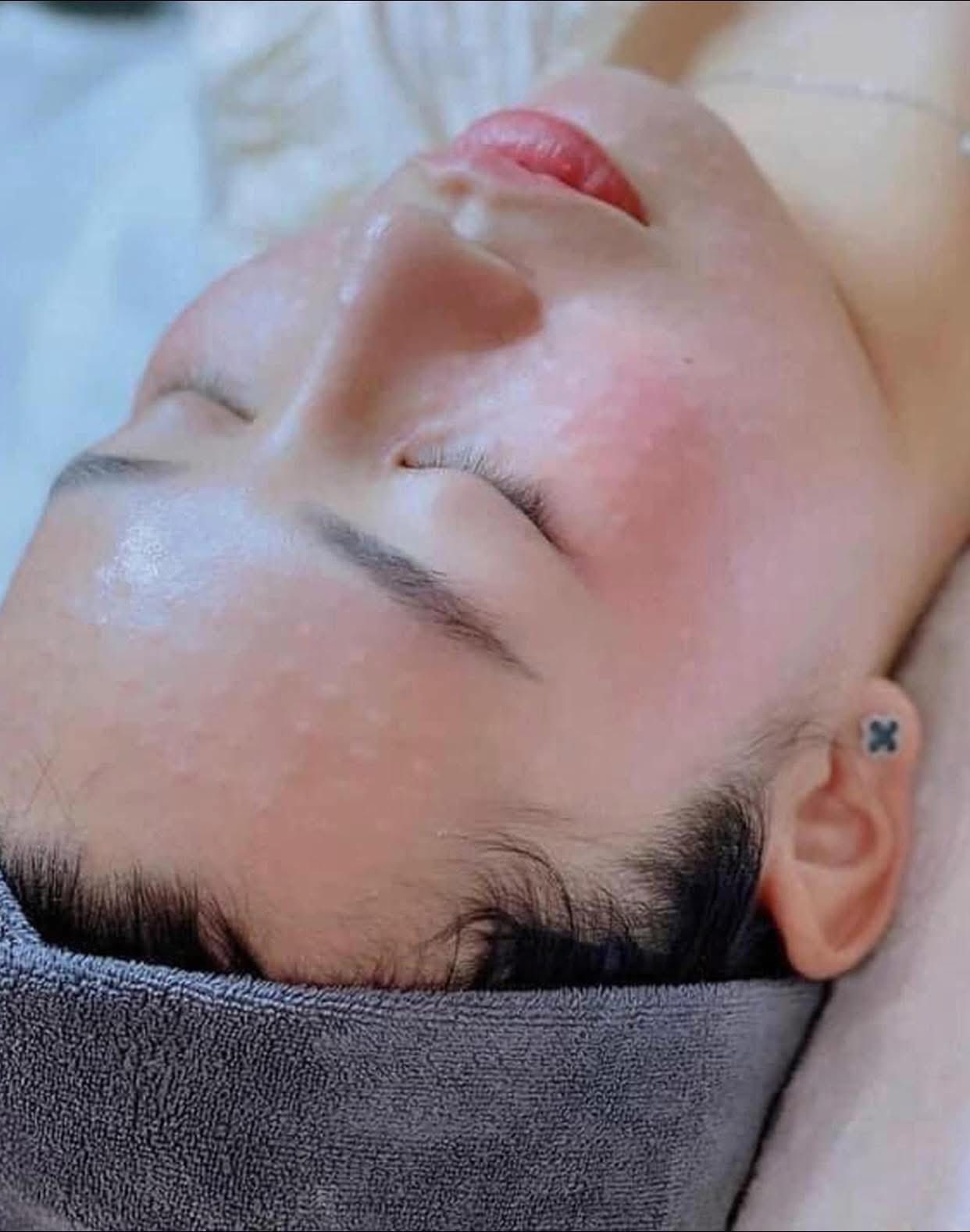 Vì Sao Có Người Tiêm Meso Da Đẹp, Có Người Thì Không