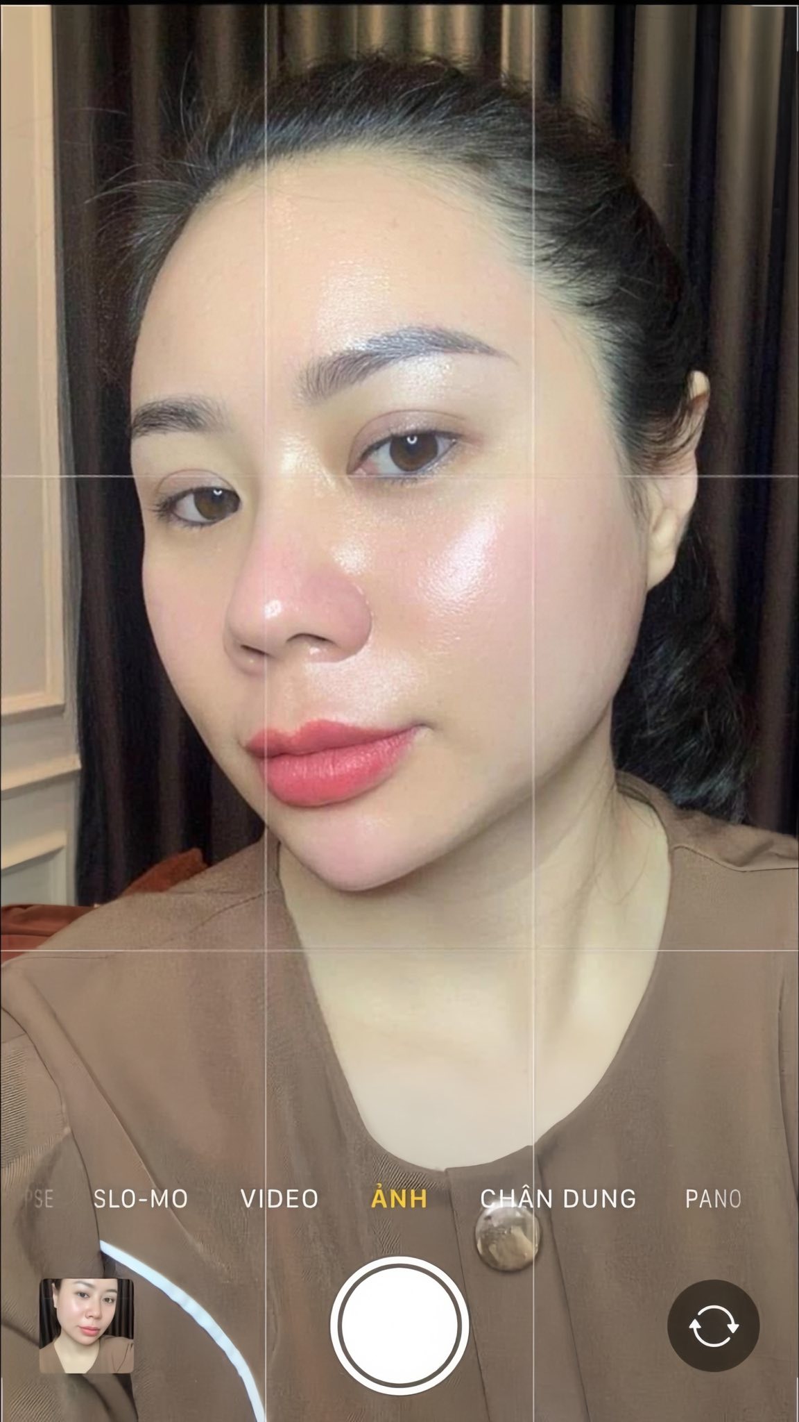 Vì Sao Có Người Tiêm Meso Da Đẹp, Có Người Thì Không