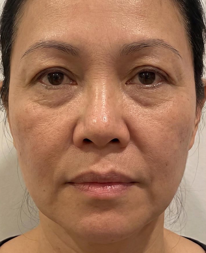 danh-gia-dich-vu-tiem-meso-1