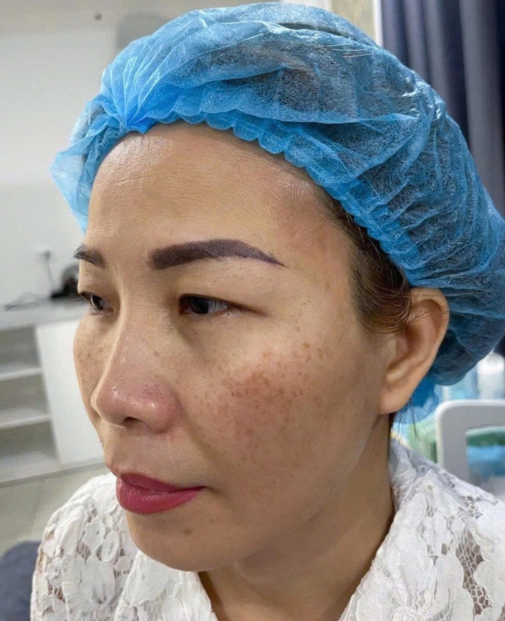 danh-gia-dich-vu-tiem-meso-3