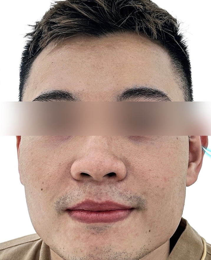 danh-gia-dich-vu-tiem-meso-5