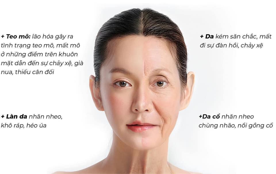 Tiêm BAP Phục Hồi Da Yếu, Da Tổn Thương