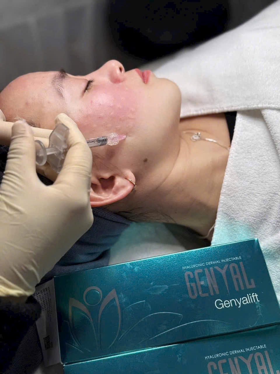 Tiêm Meso Trẻ Hóa Da Có Khiến Da Nhìn Trẻ Hơn Không