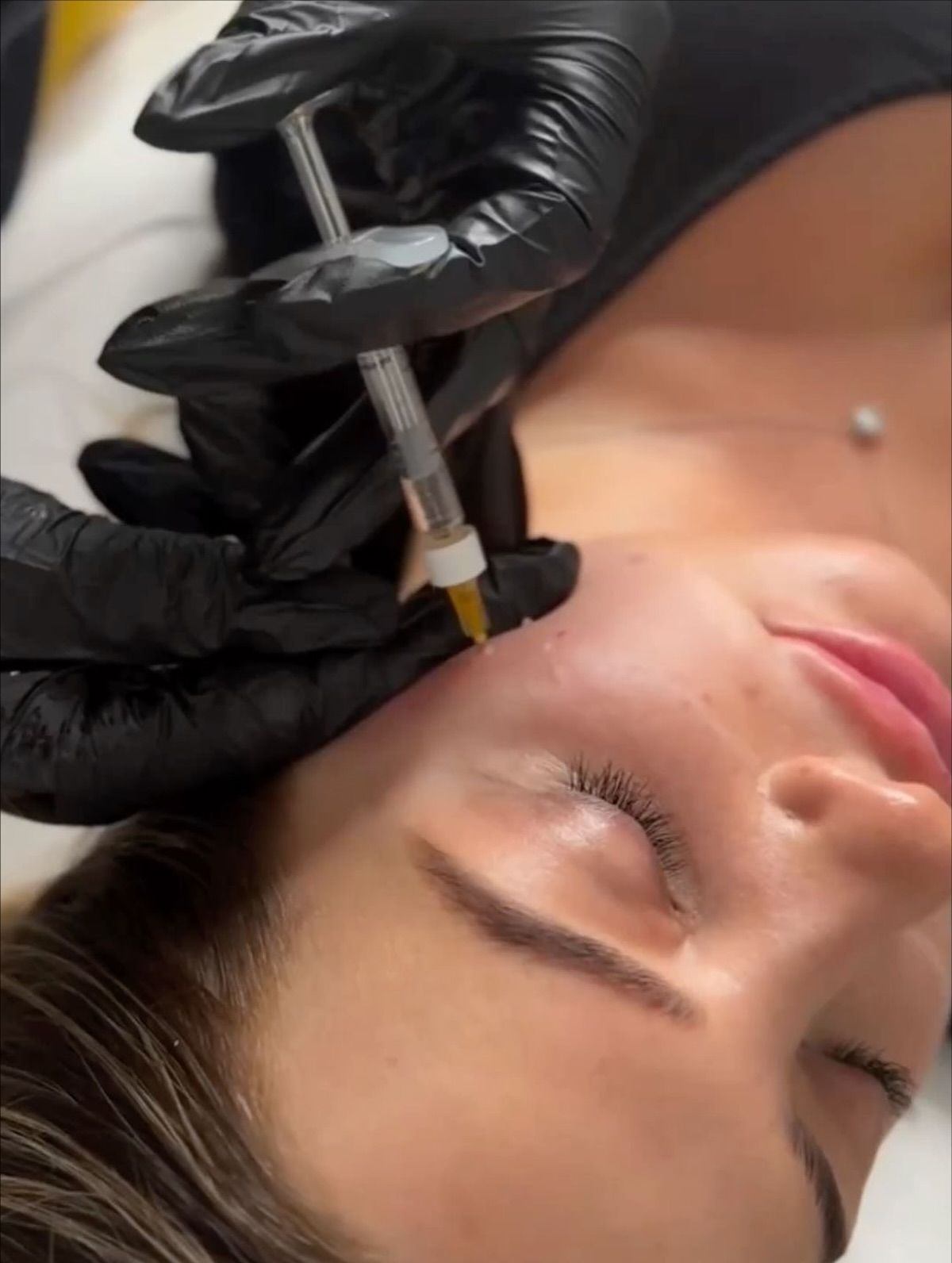 Dịch Vụ Tiêm Meso Tại Nhà Hoạt Động Như Thế Nào