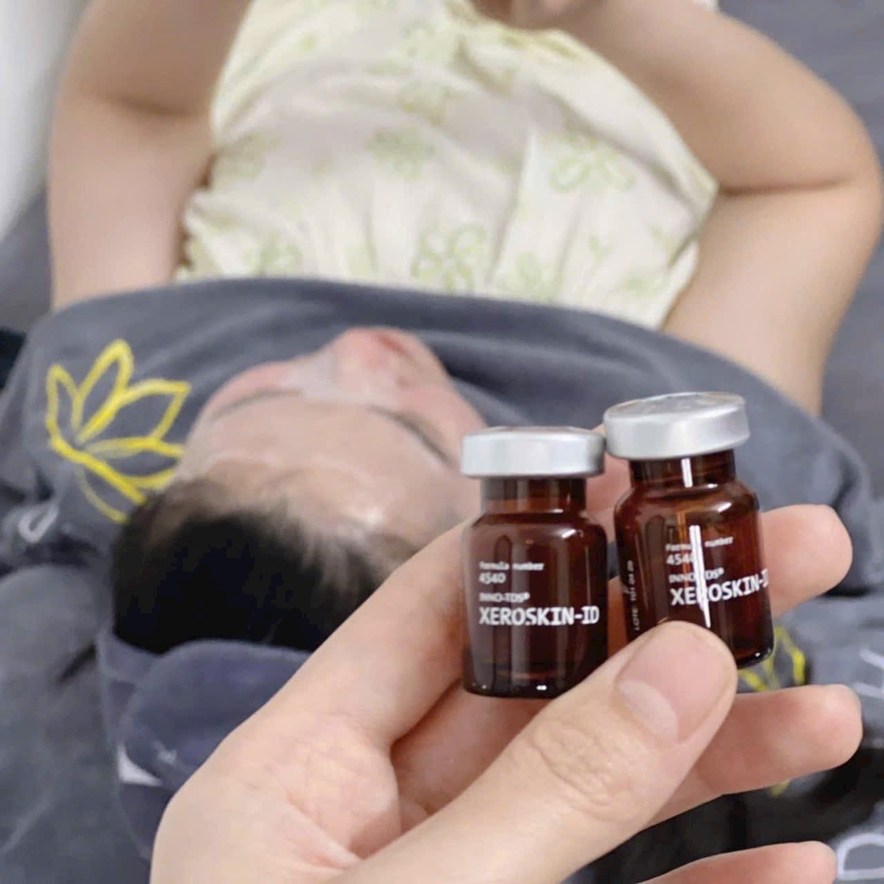 Tiêm BAP Có Hiệu Quả Hơn Meso Không