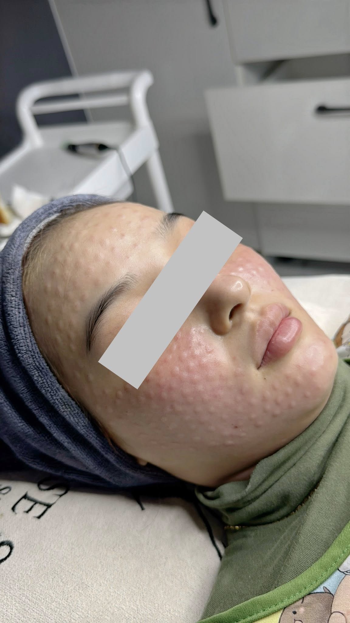 Tiêm Meso Không Rõ Nguồn Gốc Có Hại Thế Nào