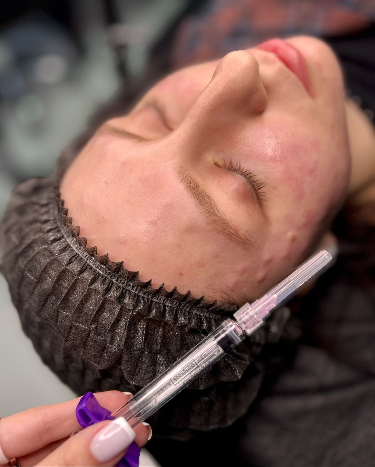 Tiêm Meso Nhưng Chưa Thấy Hiệu Quả Như Quảng Cáo