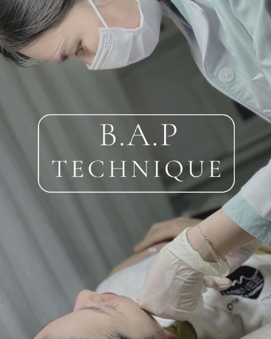 Tiêm B.A.P nâng cơ 5 điểm - Trẻ hóa đa tầng, tự tin đón nắng hè