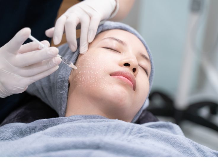 Tiêm Meso Xong Thì Khi Nào Rửa Mặt