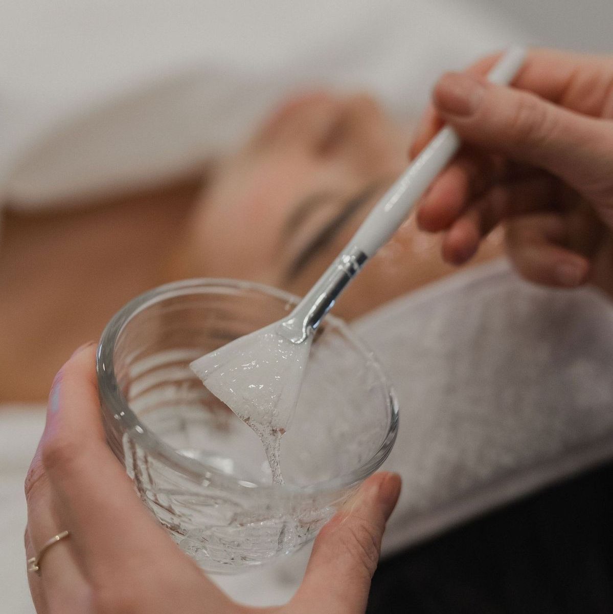 Điều Trị Mụn Bằng Meso trị mụn Hay Peel Da Hiệu Quả Hơn?